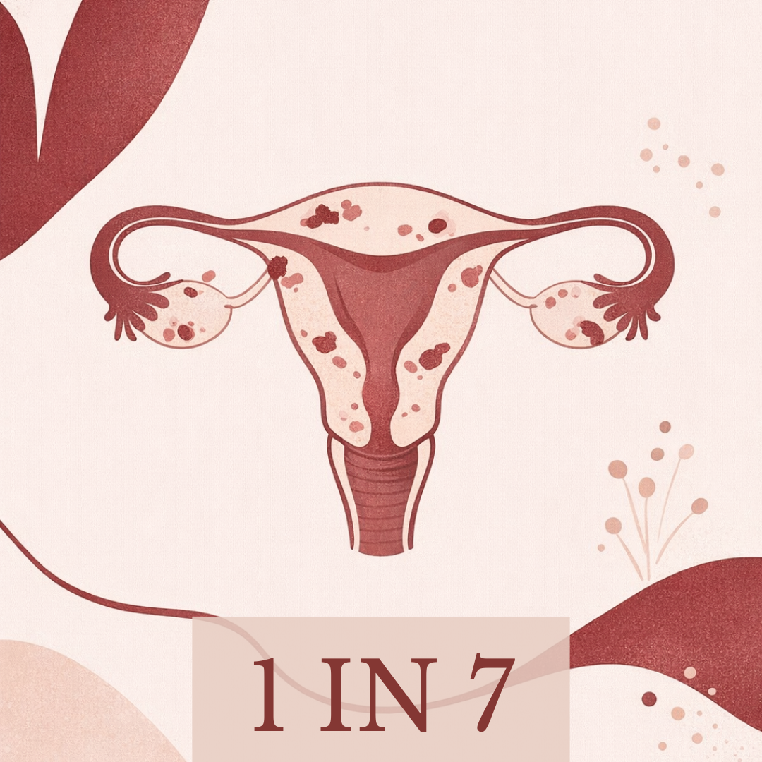 Endometriosis: What Every Woman Should Know