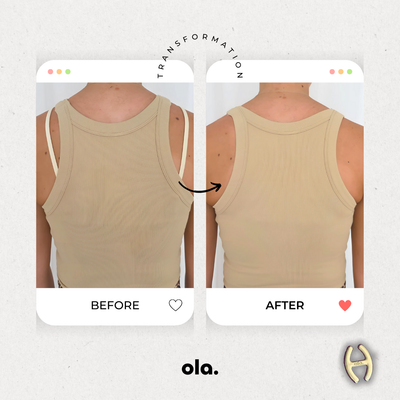 Strap Hack: The Ola Racerback Clip